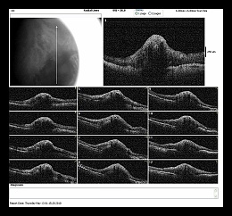 RADIAL LINE OD